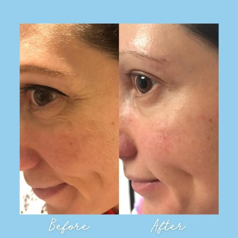 Age Defying Lifting Serum - Billede 4